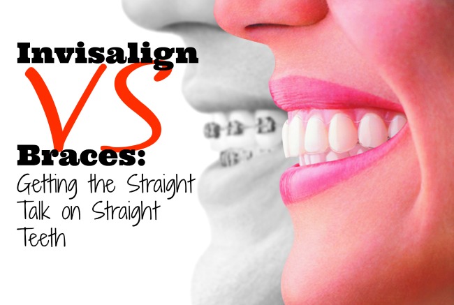 invisalign-versus-braces