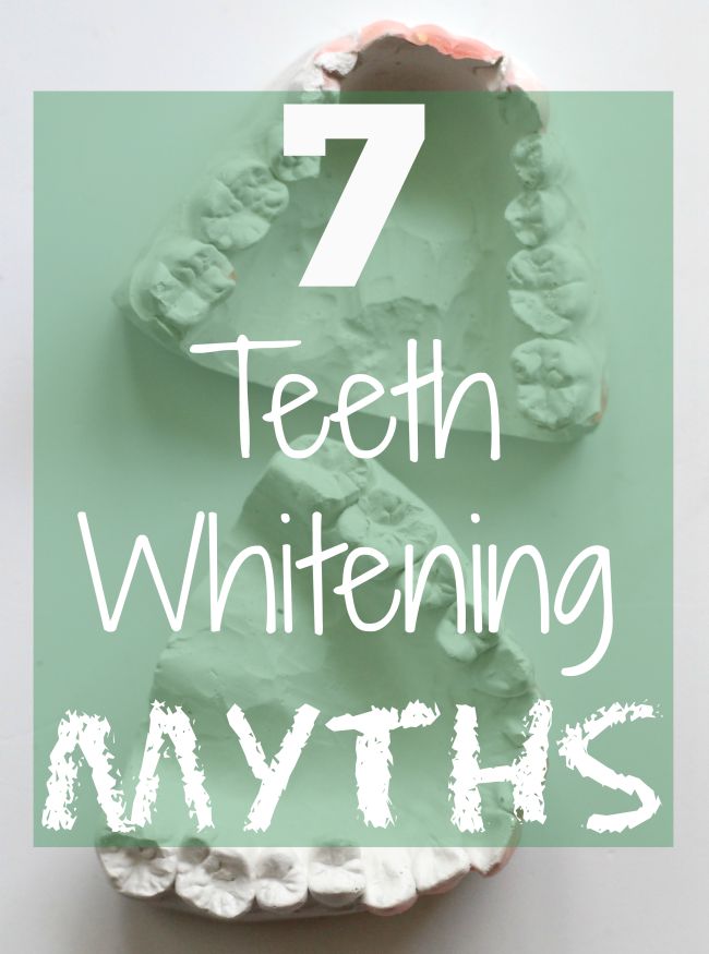 Teeth whitening myths busted with smile brilliant