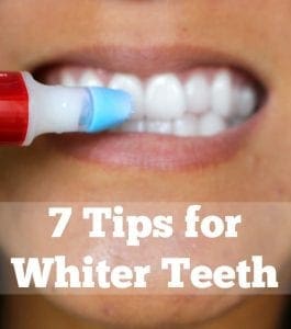 Tips for whiter teeth