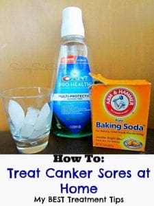 How to treat canker sores at home