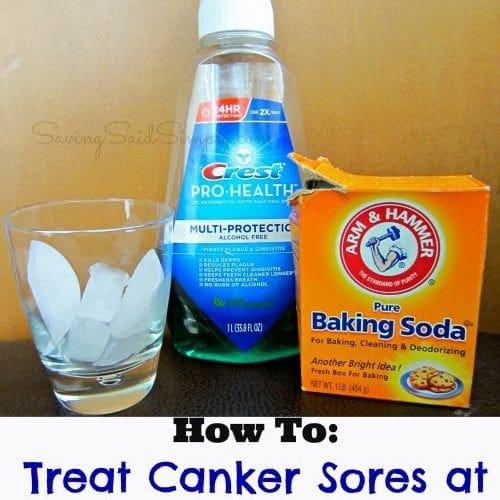 How to treat canker sores at home