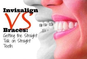 Invisalign versus braces