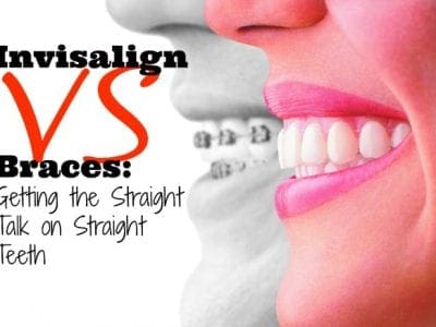 Invisalign versus braces