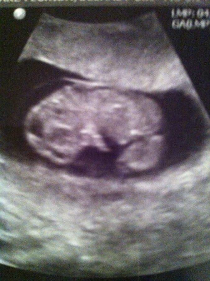 Medicine and pregnancy tips Medicine and pregnancy tips